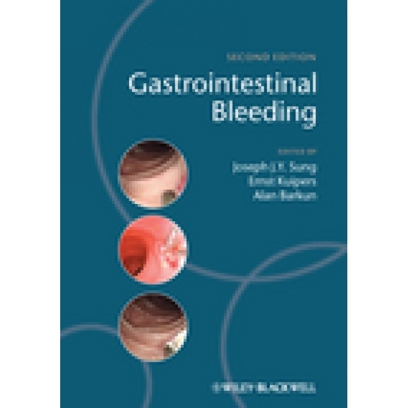 Gastrointestinal Bleeding, 2nd Edition